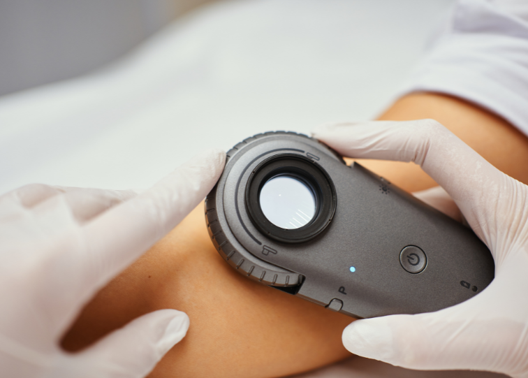 IDS-1100 Dermatoscope