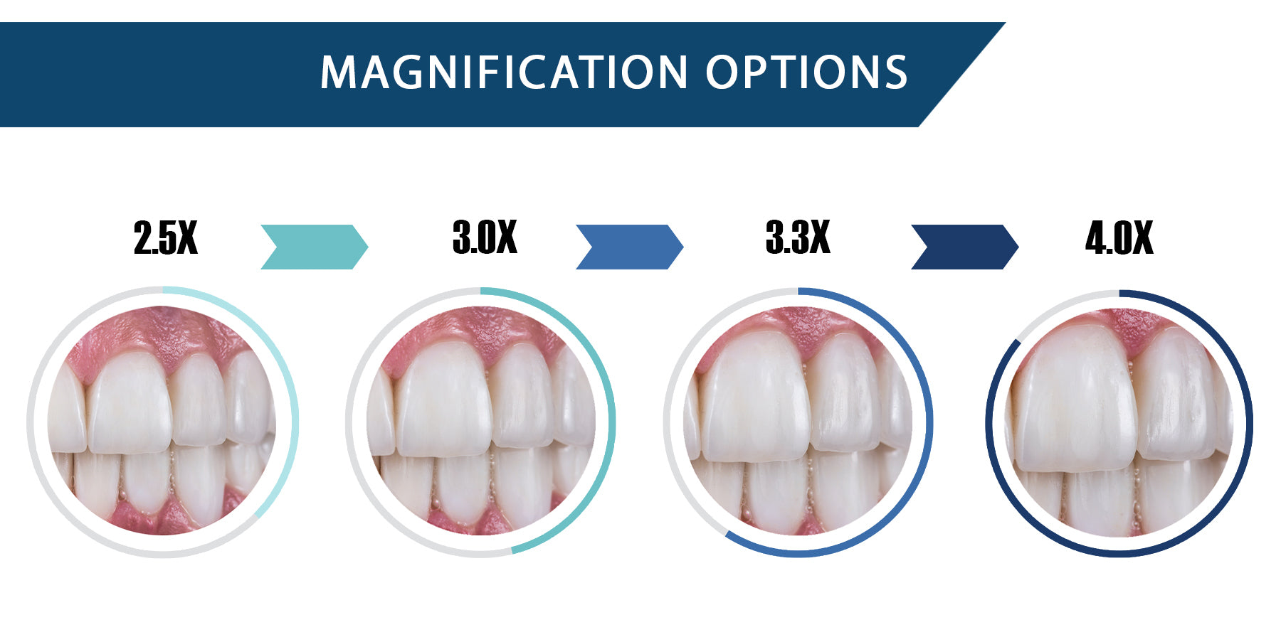 ILLUCO Magnification Options