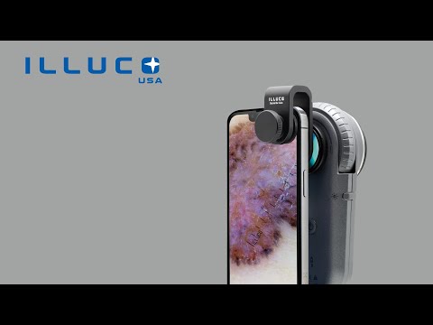 ILLUCO IDS 1100 Dermatoscope with phone compatibility