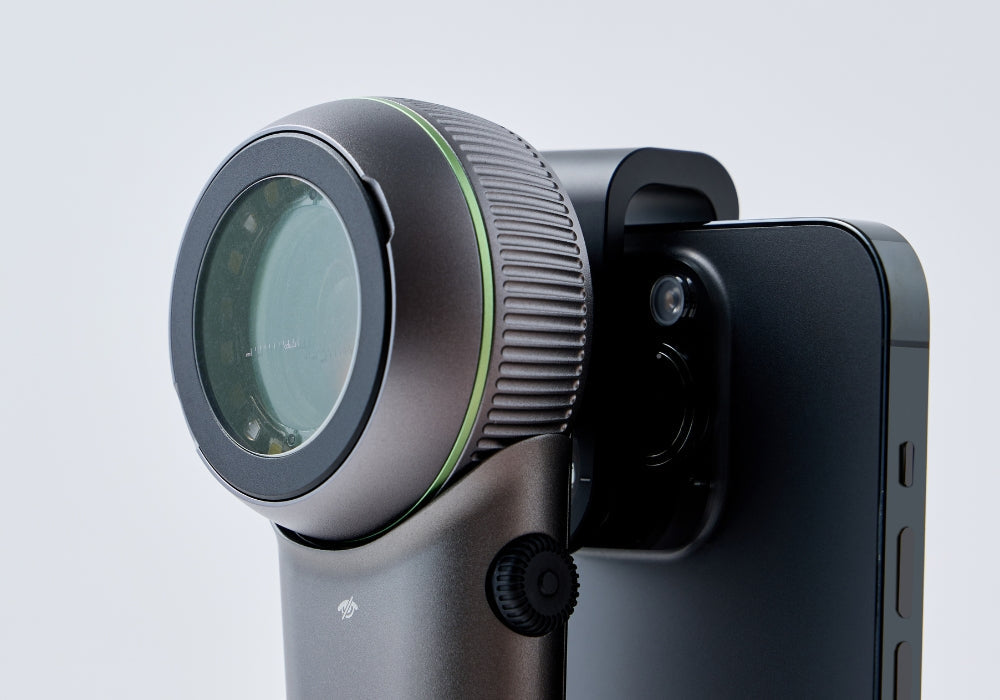 What Is Diopter Compensation in a Dermatoscope?