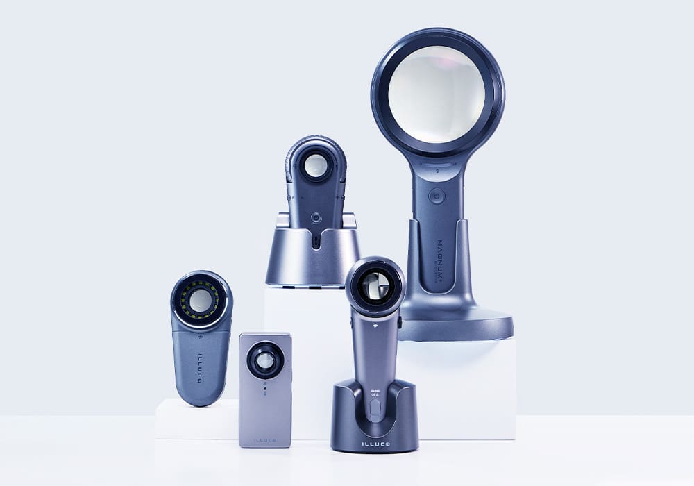 arly skin cancer detection was the original driver behind dermoscopy's adoption, and it remains a core application