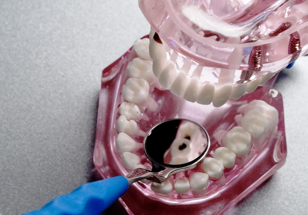 ILLUCO double sided dental mirror in use