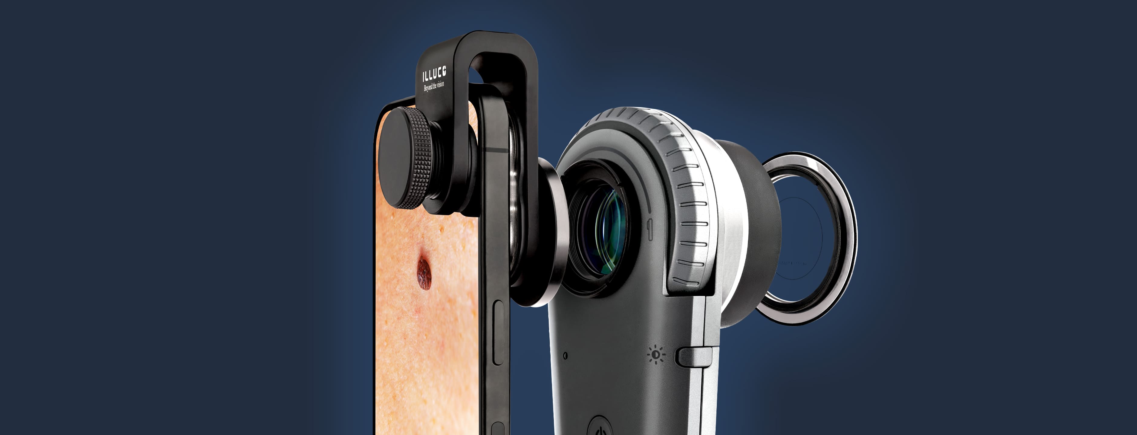 IDS-1100 with a phone camera attachment