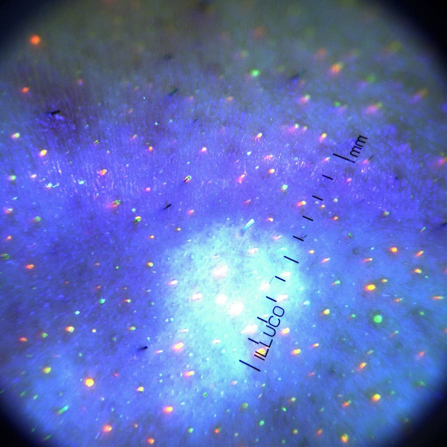 9100 dermatoscope showing UV