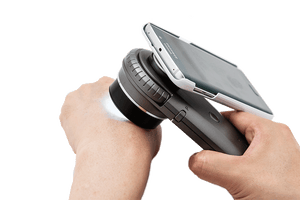 IDS-1100 dermatoscope with phone adapter