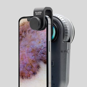 Illuco IDS 1100 series phone adapter