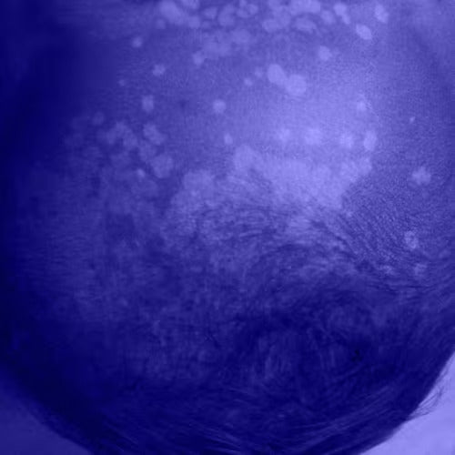 blemish or lesion shown from a dermatoscope