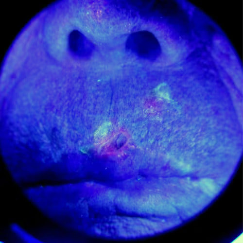 blemish or lesion shown from a dermatoscope